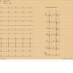 Electrocardiograph CM1200B Comen - Sudut / Detail 6