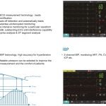 Patient Monitor C50 Comen - Sudut / Detail 6