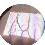 Blood Vascular Transilluminator Vein Finder - Sudut / Detail 3